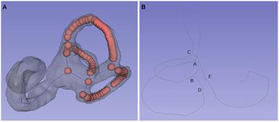 Measurement of Human Semicircular Canal Spatial Attitude